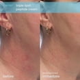thumbnail image 5 of Skin Fix Skinfix Barrier Triple Lipid-Peptide Cream 1.7 Oz, 5 of 5