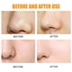 thumbnail image 5 of Minnieouse 10 piezas parche nasal hidrocoloide cuidado de la piel parches para espinillas cabeza negra salón doméstico almohadilla para dormir Tratamientos faciales Blanco, 5 of 6