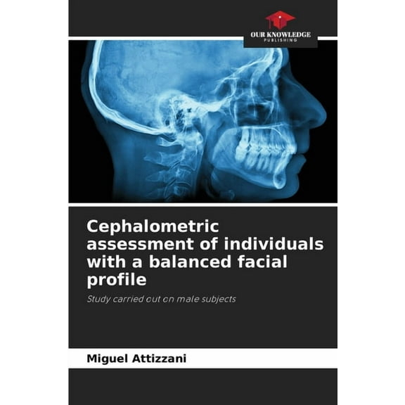 Cephalometric assessment of individuals with a balanced facial profile, (Paperback)