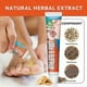 thumbnail image 3 of Fungal Foot Cream for Itch Relief, Anti-Fungal Skin Treatment, Effective Antifungal Solution for Feet and Skin Care, 3 of 5