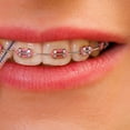 thumbnail image 3 of EIGTHTAIL Support de Dentition en Acier Inoxydable Support Orthodontique Support de Sécurité, 3 of 4