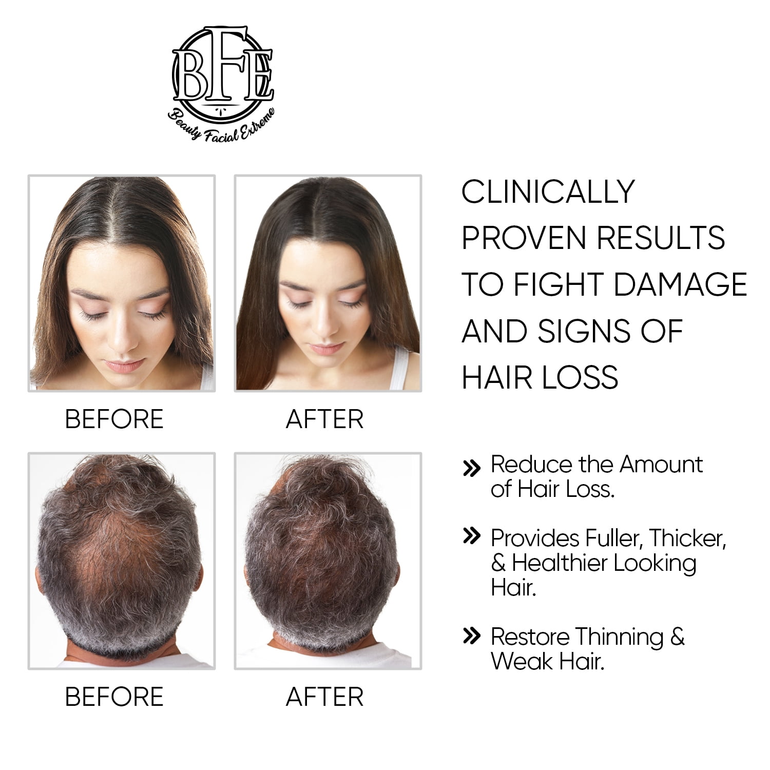 Hair Rejuvenation Serum- Maximum Strength DHT Blocker. Repairs & Stimulates New Follicle Hair Growth. Grow Stronger, Thicker, Fuller, Longer, Healthier Looking Hair. For Men & Women.