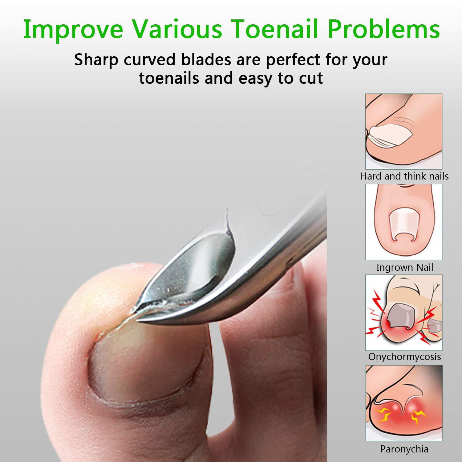 RONAVO Professional Toenail Clippers for Thick Nails for Seniors - Thick  Toenail Clippers for Men - Large Handle for Easy Grip + Sharp