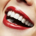 thumbnail image 6 of Sparkle White Teeth Whitening Kit Complete 3D at Home Teeth Whitening System, 6 of 9