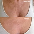 thumbnail image 2 of Wrinkles Schminkles Chest Silicone Patch - Reusable 8-10 Times (1 per pack), 2 of 5