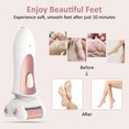 thumbnail image 1 of Electric Callus Remover USB Rechargeable Electronic Feet File Pedicure Foot File Foot Rasp for Dry Cracked Dead Skin, 1 of 8