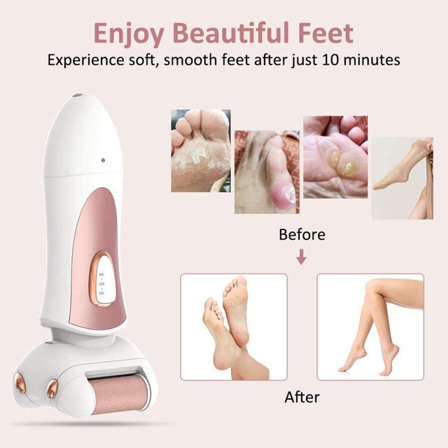 Electric Callus Remover USB Rechargeable Electronic Feet File Pedicure Foot File Foot Rasp for Dry Cracked Dead Skin