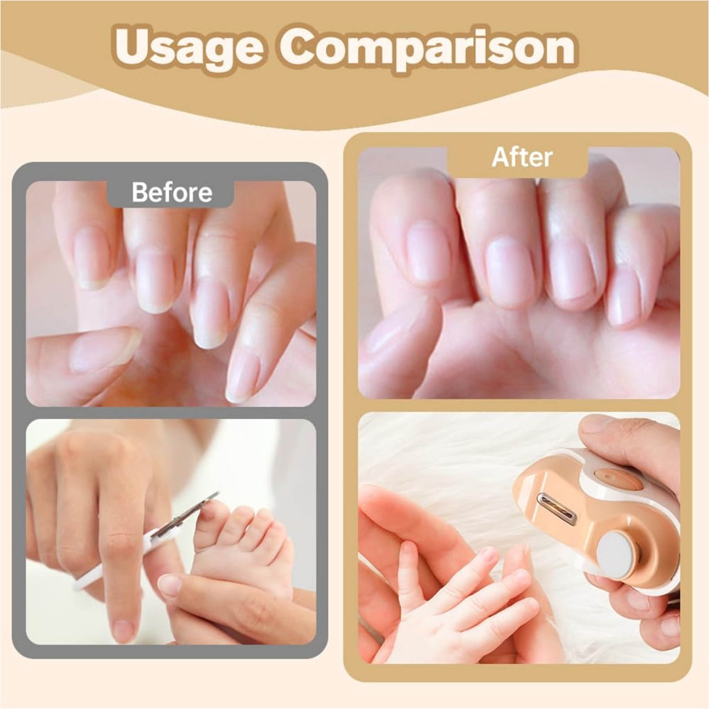 Automatic Unguis Mill For Delicate Tender Infant Elderly Use Double Function ABS Substance
