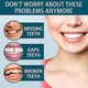 thumbnail image 2 of Adjustable Snap On Prothesens, Adjustable Snap On Denture, Silicone Whitening Denture Braces, Cover, 2 of 4