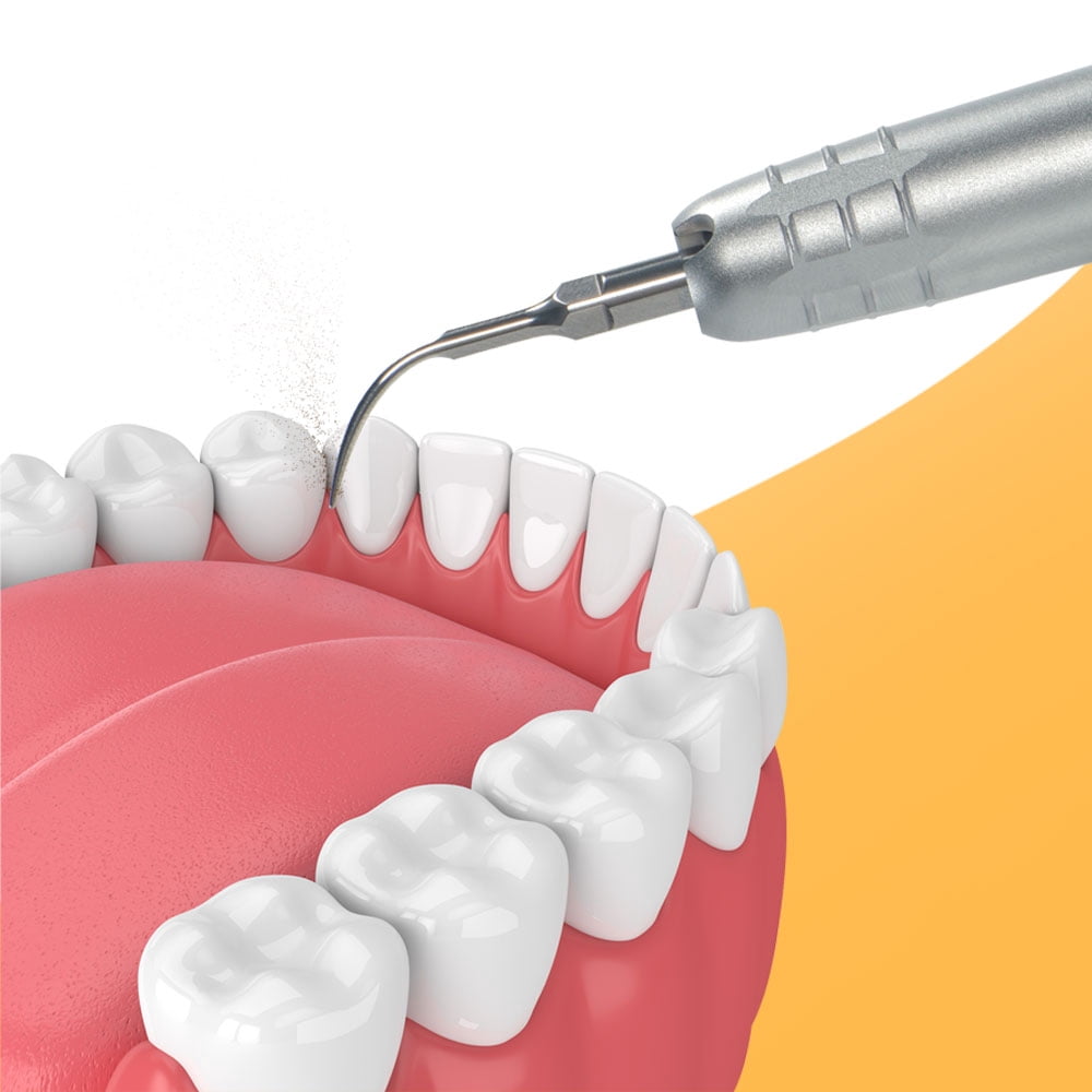 Dental Ultrasonic Air Scaler With 3 Tips Tooth Calculus Remover Cleaning Tool Handpiece Whiten Tooth Cleaner 2Holes/4 Holes