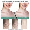 thumbnail image 4 of Dolphin Face Neck Eye Massager, 4 of 5
