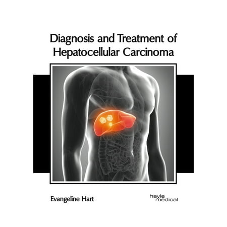 UPC: 9781632418517 | Diagnosis and Treatment of Hepatocellular Carcinoma (Hardcover)