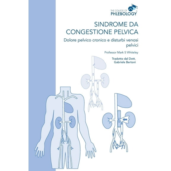Sindrome da congestione pelvica - Dolore pelvico cronico e disturbi venosi pelvici, (Paperback)