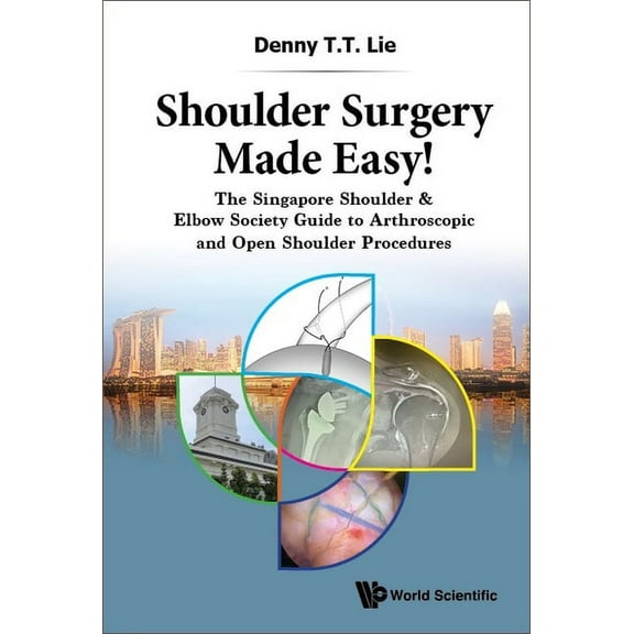 Shoulder Surgery Made Easy!, (Hardcover)