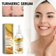 thumbnail image 5 of Fiudx Liquidación De Ahorros De Verano Suero Corrector Oscuro De Cúrcuma 2024, Nuevo Suero Facial Reparador De Cúrcuma, Suero Facial Corrector Oscuro De Piel Brillante, 30Ml, 5 of 6