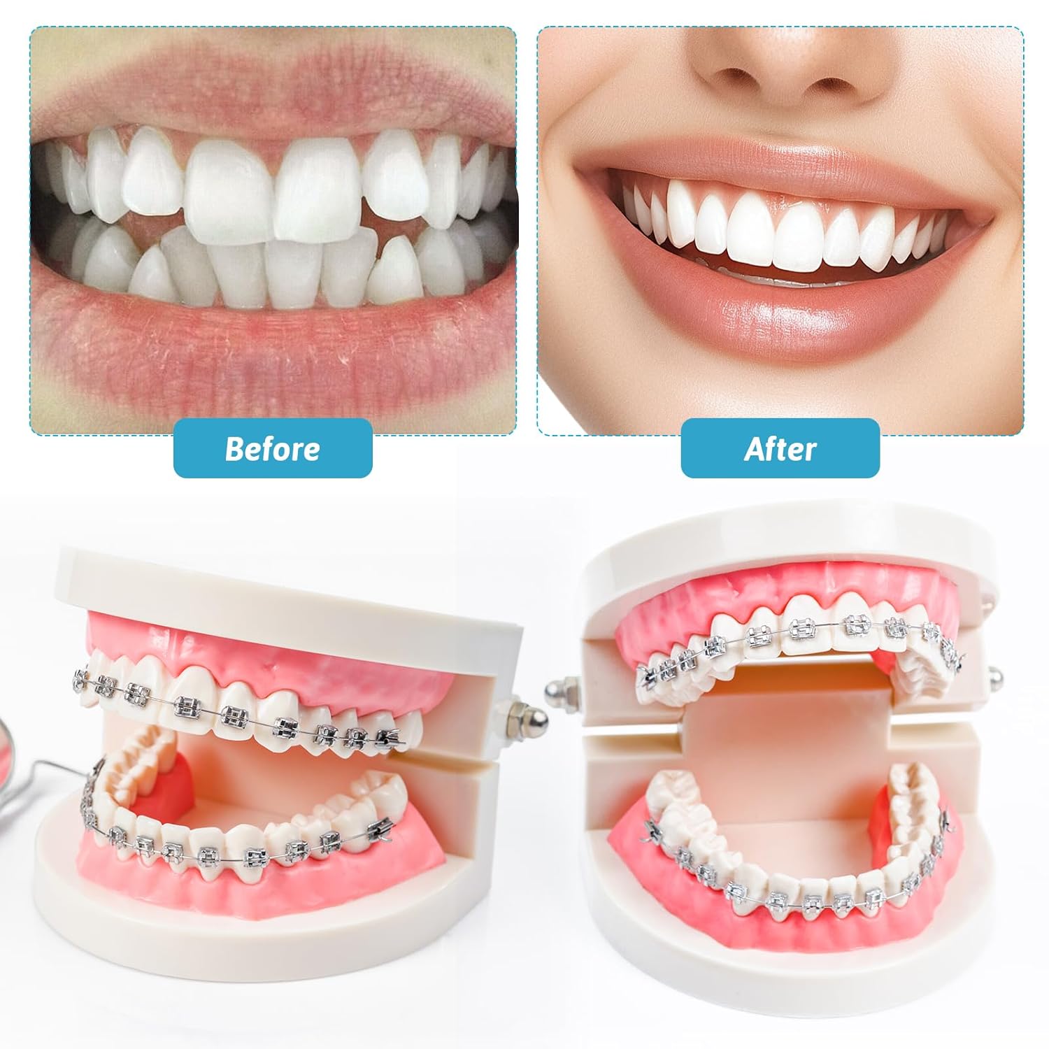 ABCISI Fake Braces, Brackets Falsos Para Dientes Kit 2 Pack, Braces Kit with Brackets & Wire & Glue, Brackets Para Dientes DIY Retainer for Teeth, Dental Student Practice Props (Blue)