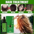 thumbnail image 5 of Natural Hair Growth Serum for Men & Women, Anti-Hair Loss Treatment, 120ml Spray Oil for Hair & Beard Care Essentials Kit, 5 of 5