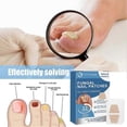 thumbnail image 2 of 32 Pcs Toenail Fungus Treatment, Nail Repair Patches , Foot Patch, Treatment For Restores Damaged Nails And Appearance Of Discolored, 2 of 5