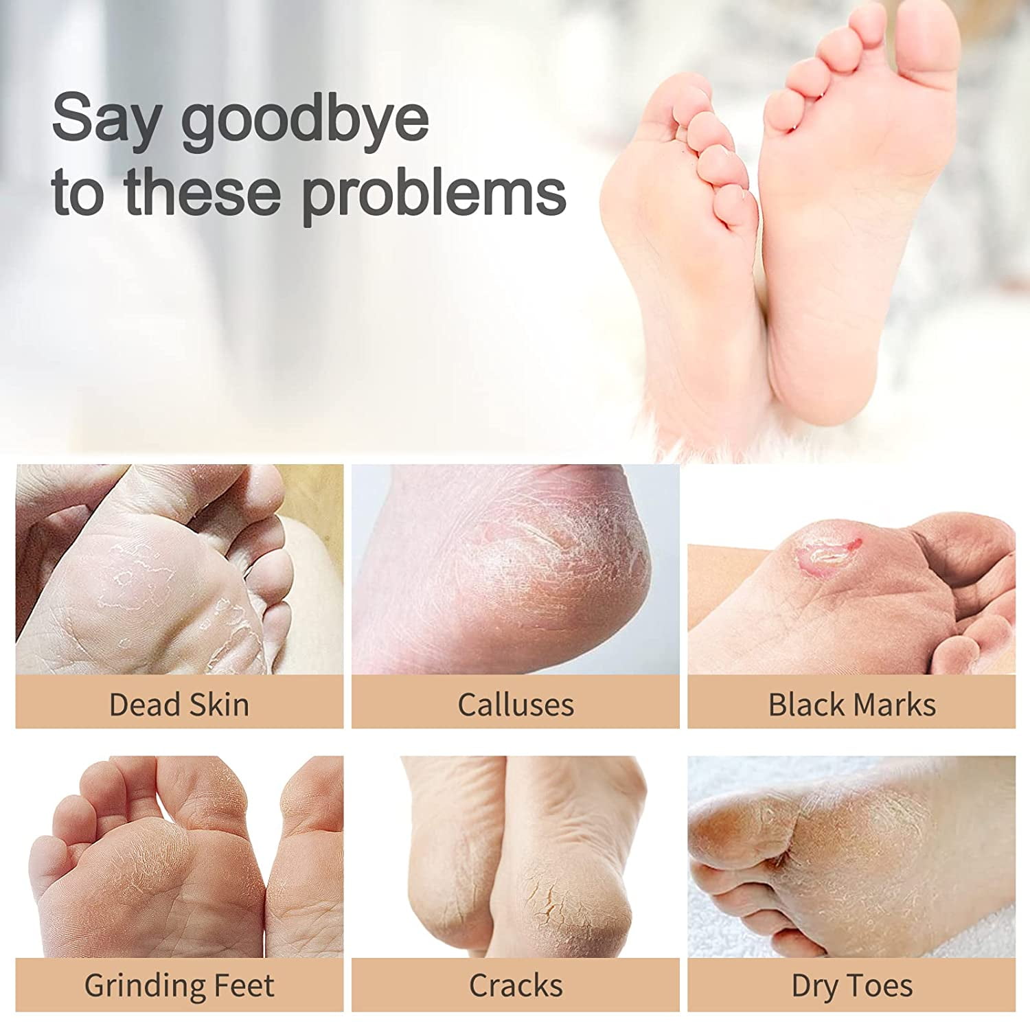 Natural 3-in-1 Foot Peel Mask for Cracked Heels Nigeria Ubuy