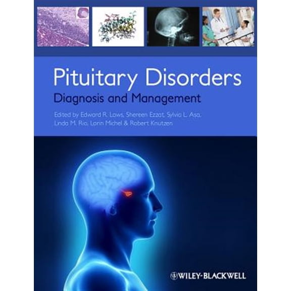 Pre-Owned Pituitary Disorders, (Paperback)