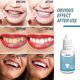 thumbnail image 1 of Eelhoe Tooth Whitening Liquid Tooth Liquid Tooth Black Tooth Smoke Tooth Fresh Breath Brightening 26-27s, 1 of 3