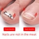 thumbnail image 3 of Vogacara Juego de 3 piezas de Corrector de uñas de acero inoxidable, herramienta para el cuidado de los pies, herramienta para recuperar el cuidado de Suministros de ortodoncia Vogacara CE001666-00, 3 of 8