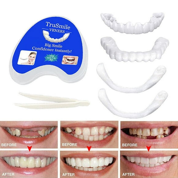 Smile Snap On False Teeth Upper Lower Dental Veneers Dentures Tooth Cover