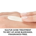 thumbnail image 3 of Corrector de manchas Vichy Normaderm S.O.S Acne Rescue 10% de azufre, 3 of 9