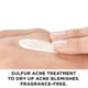 thumbnail image 3 of Corrector de manchas Vichy Normaderm S.O.S Acne Rescue 10% de azufre, 3 of 9