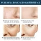 thumbnail image 3 of 60 uds., relleno facial, antienvejecimiento, líneas de estiramiento facial, eliminación de arrugas, productos para el cuidado de la belleza, 3 of 9