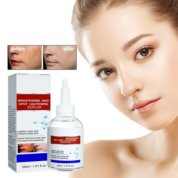 SDJMa Brightening Serum with Hyaluronic Acid, Brightening Serum for Dark Spots & Dullness, Moisturizing Formula, 30ml