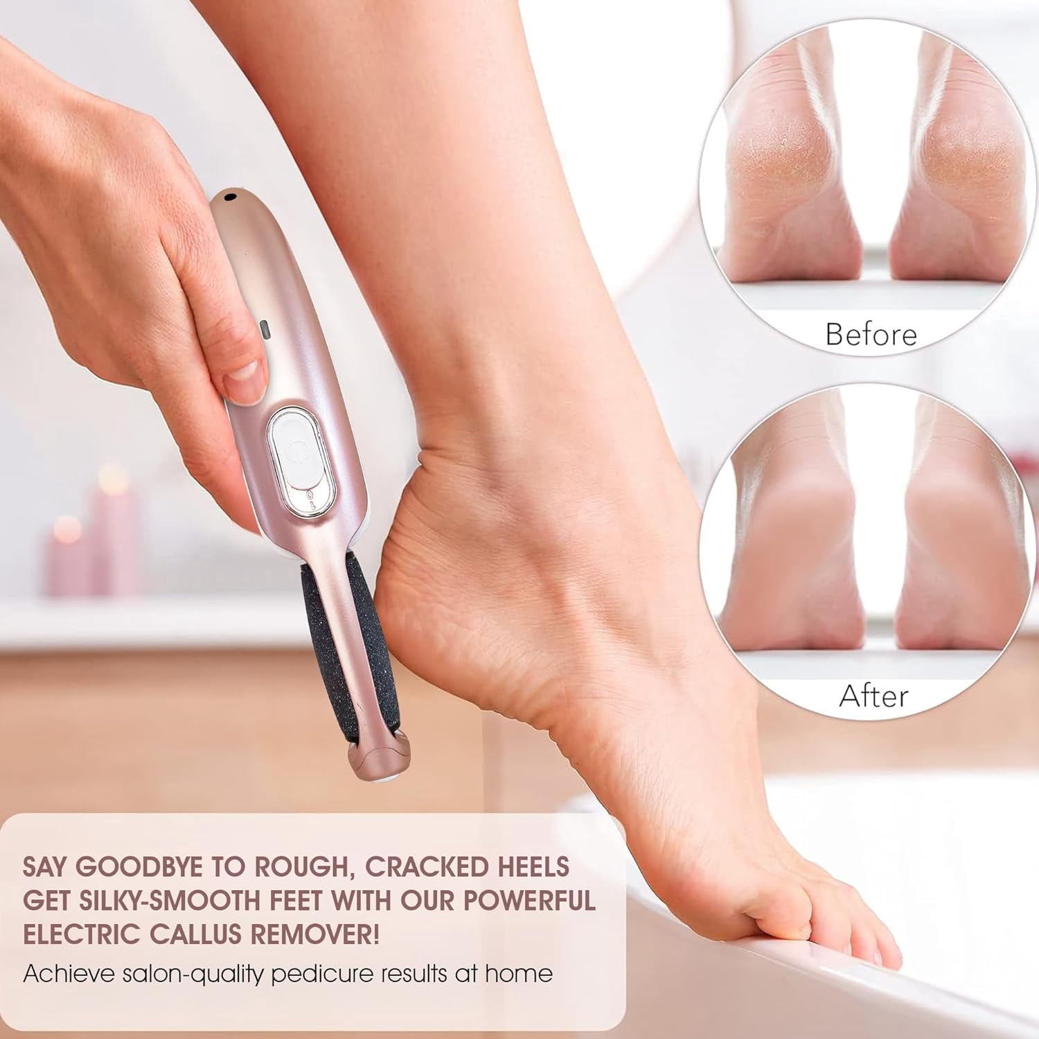 Care Me Powerful Electric Foot Callus File Removes Dry, Dead, Hard Skin, Callous for Pedicure Spa-like Smooth & Soft Feet