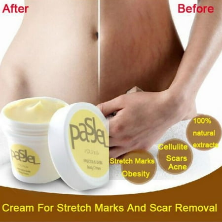 corp slim stretch mark eraser hypno band pierdere în greutate recenzii