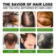thumbnail image 2 of 20 ml de aceite de crecimiento rápido del cabello, suero Natural para el crecimiento del cabello, loción para el cuidado anticaída del cabello Ygjytge Cuidado Belleza, 2 of 5
