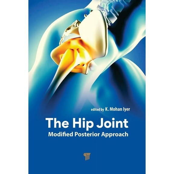 The Hip Joint: Modified Posterior Approach, (Hardcover)