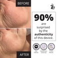 thumbnail image 4 of Dispositivo facial con microcorriente 7E Wellness MyoLift Mini, 4 of 6
