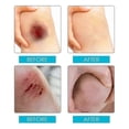 thumbnail image 2 of Jaysuing Waterproof Liquid Band-Aid Spray Wound Protection Invisible Film Forming Waterproof Breathable Care Spray | | 30Ml Boxed |, 2 of 5