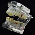 thumbnail image 4 of 14k Gold Plated Drip Grillz Dripping Bottom Hip Hop Melting Teeth Bling Grills, 4 of 5
