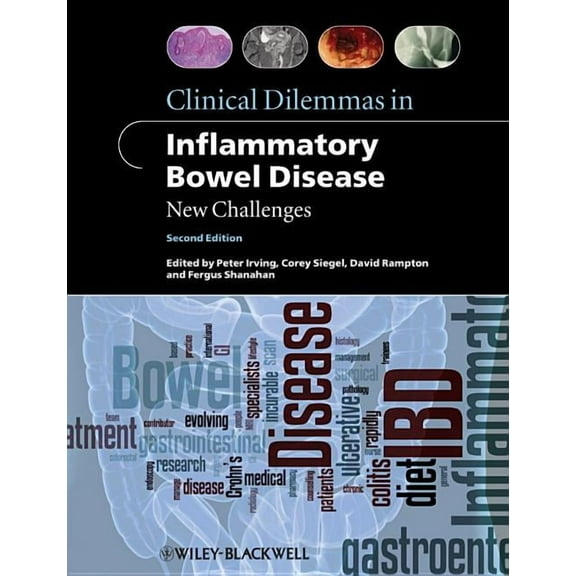 Clinical Dilemmas (UK) Clinical Dilemmas in Inflammatory Bowel Disease, (Paperback)