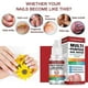 thumbnail image 2 of Fungal Nail Treatment For Toenails Extra Strong,nail Fungus Treatment For Toenail,toenail Fungus Treatment, 2 of 5