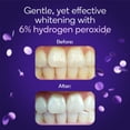 Whitening Teeth At Home: Burst Strips Guide - htl4om1