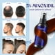 thumbnail image 2 of Sérum de tratamiento para el crecimiento del cabello RootStim 5% Minoxidil 60 ml, 2 of 9