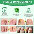 thumbnail image 2 of Nail Treatment, 7-Day Nail Fungus Treatment, Nail Repair & Strengthen Cuticles, 2.02 FL.OZ, 2 of 8
