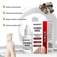 thumbnail image 5 of 15ml Fungi Nail Treatment Liquid Fast-Acting Nail Repair Strengthening Liquid Nails Care Supplies, 5 of 5