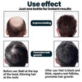 thumbnail image 5 of Solución tópica para el tratamiento de la caída del cabello en hombres, 5 of 5
