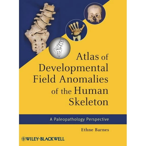 Atlas of Developmental Field Anomalies of the Human Skeleton, (Hardcover)