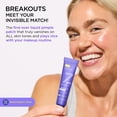 thumbnail image 2 of Pimple Patch ZitSticka UNDERCOVER Liquid con ácido salicílico, 2 of 8