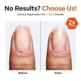 thumbnail image 4 of modelones Nail Strengthener and Growth Scented Nail Repair for Damaged Nails Hardener Extra Strong and Growth 3-in-1 Repair Mode Gifts for Women 13.5ml 0.46 Fl Oz, 4 of 10