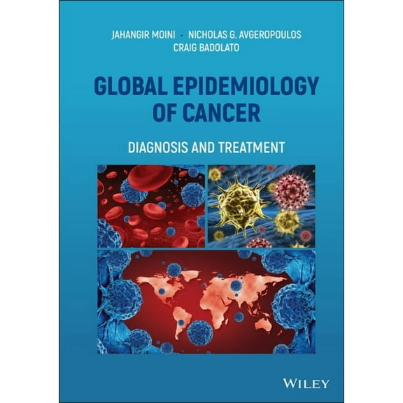 Global Epidemiology of Cancer: Diagnosis and Treatment, (Hardcover)