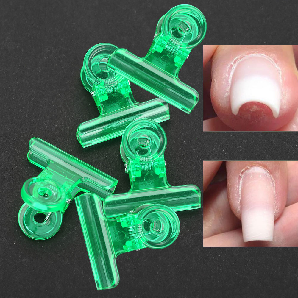 Qiilu 5pcs 4 Colors C Curve Nail Extension Clips Multifunctional